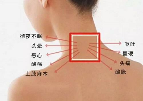 你的頸椎還健康嗎？