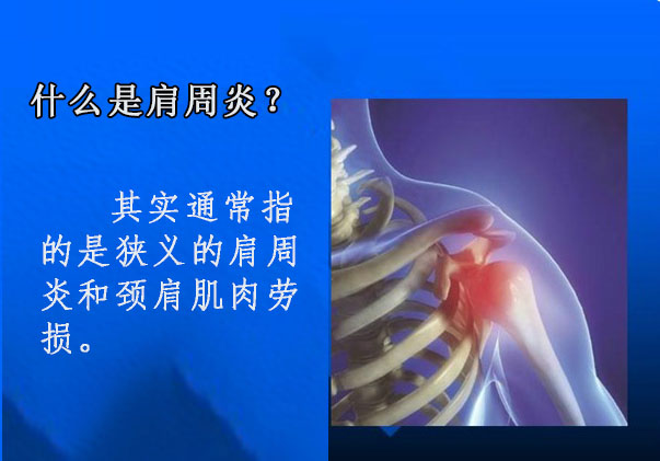 長時間坐電腦前工作肩膀疼痛怎么辦？