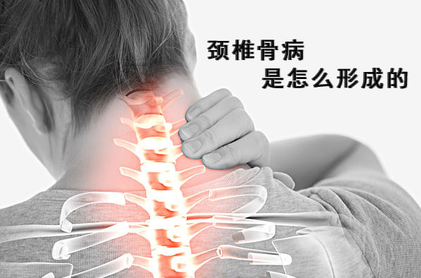 頸椎骨病是怎么形成的—玄鹿中頻治療儀