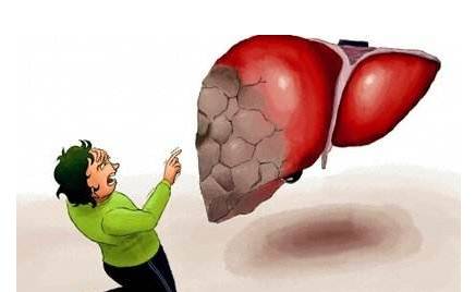 頭部出現(xiàn)這4種狀況，就要注意你的肝了！