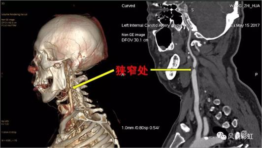 頸椎病都是“積”出來的，4個(gè)傷頸的行為，別總是做